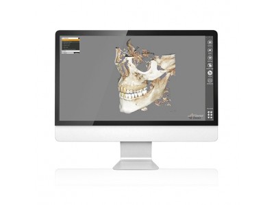 xCAD / EXOPLAN Flex License mit Guide-Creator (Galway 3.0)