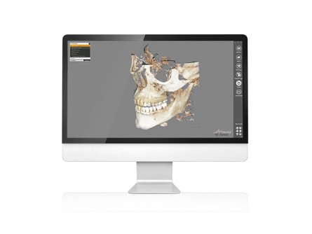 xCAD / EXOPLAN Flex License mit Guide-Creator (Galway 3.0)
