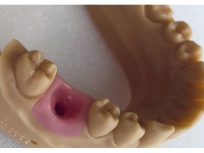 DREVE - FotoDent® gingiva 385nm