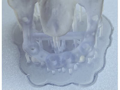 DREVE - FotoDent® guide 385nm