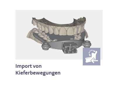xCAD Jaw Motion Import (Exocad - Add on Modul)
