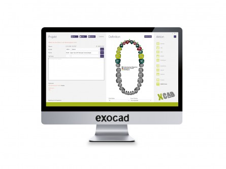 Exocad Rijeka 3.1 CAD Software (Ultimate Bundle)