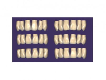 xCAD Tooth Library ZRS Wiedmann (Exocad - Add on Modul)