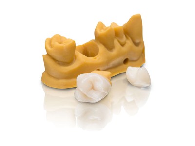 Resin - VarseoSmile Crown plus